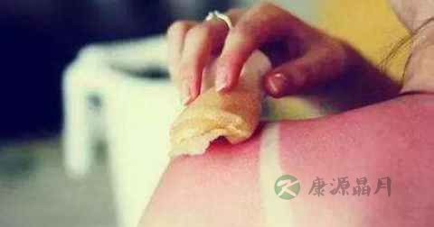 皮癣什么药最好 皮癣什么药最好
