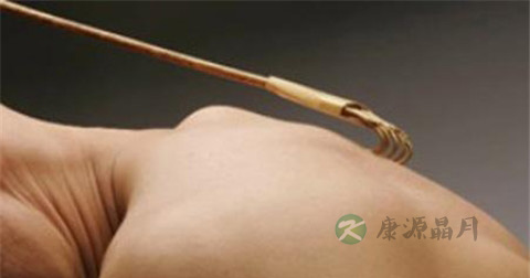 神经性皮炎吃什么调理