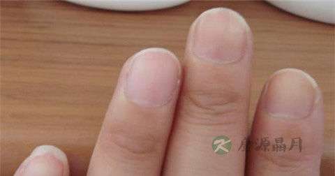 很严重的灰指甲能治好吗 很严重的灰指甲能治好吗