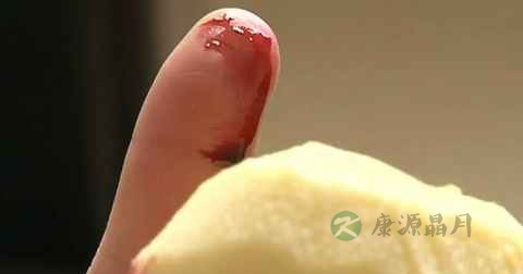 吃黄体酮能止血吗 吃黄体酮能止血吗