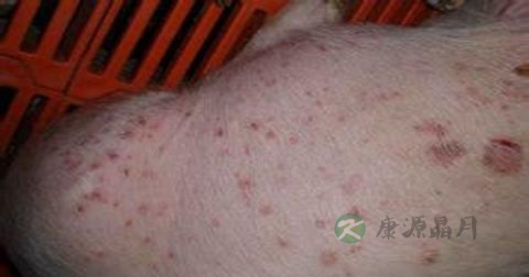 传染性红斑的治疗 传染性红斑的治疗