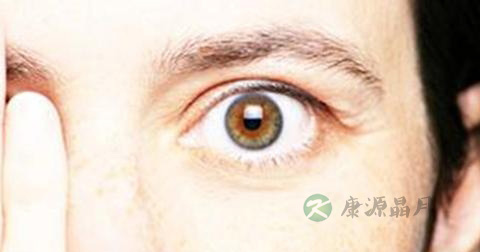 急性视神经炎怎么治 急性视神经炎怎么治