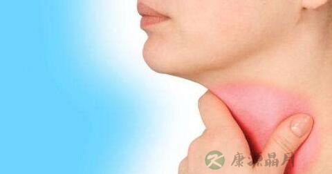 过敏性咽喉炎如何治疗 过敏性咽喉炎如何治疗