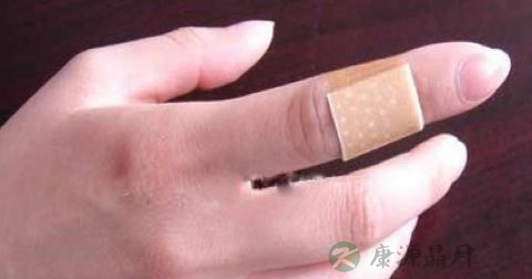 外出血的急救方法