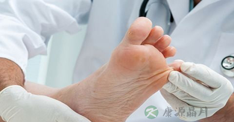 生石灰烧伤应如何处理 生石灰烧伤应如何处理
