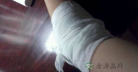 手部炸伤怎么办 手部炸伤怎么办