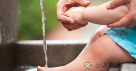 被热水烫伤怎么办 被热水烫伤怎么办