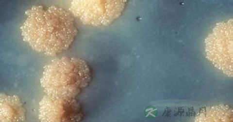什么是结核分枝杆菌 什么是结核分枝杆菌
