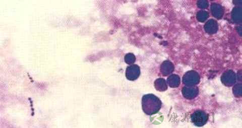 布鲁菌病传播途径 布鲁菌病传播途径