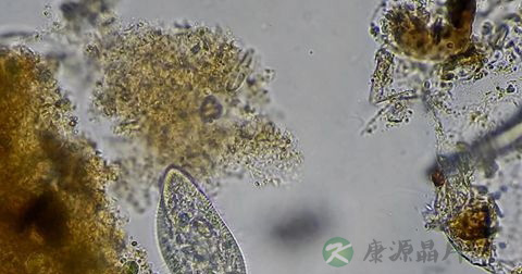 结核杆菌的传播途径 结核杆菌的传播途径