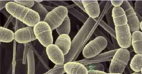 大肠杆菌是原核生物吗 大肠杆菌是原核生物吗