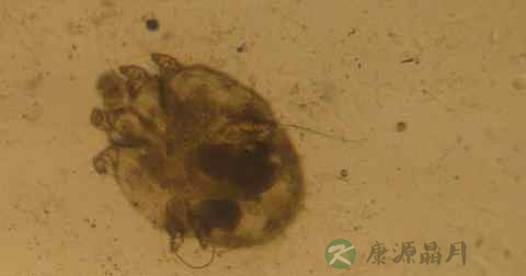 疥虫能活多久 疥虫能活多久
