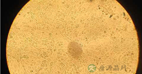酵母菌的生殖方式与细菌有什么不同 酵母菌的生殖方式与细菌有什么不同