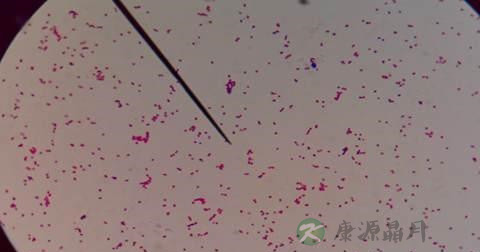 革兰氏菌的危害 革兰氏菌的危害