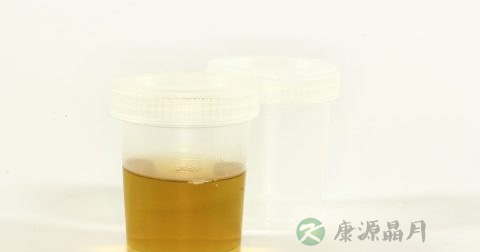 尿微量白蛋白检测试条使用方法 尿微量白蛋白检测试条使用方法