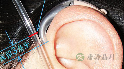 耳背式助听器如何使用 耳背式助听器如何使用
