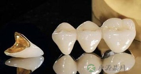 烤瓷牙有什么危害 烤瓷牙有什么危害
