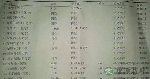 教你如何看懂尿常规化验单 教你如何看懂尿常规化验单