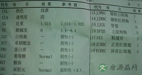 教你如何看懂尿常规化验单 教你如何看懂尿常规化验单