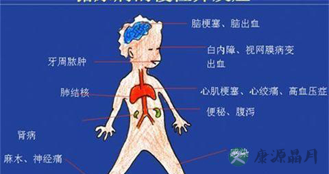 糖尿病防治知识 糖尿病防治知识