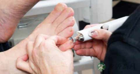 糖尿病足病的预防方法 糖尿病足病的预防方法