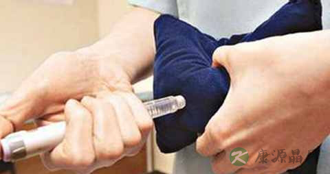 糖尿病胰岛素注射方法 糖尿病胰岛素注射方法