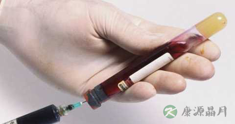 胰岛素的种类有哪几种 胰岛素的种类有哪几种