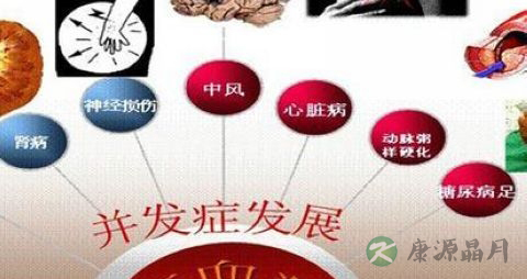 怎样控制血糖升高 怎样控制血糖升高