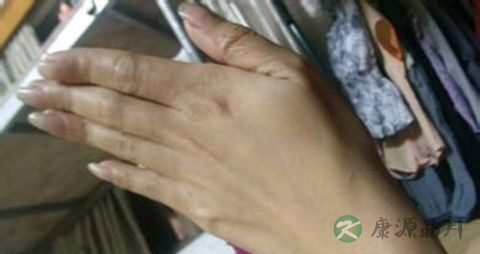 老人用什么护手霜好 老人用什么护手霜好