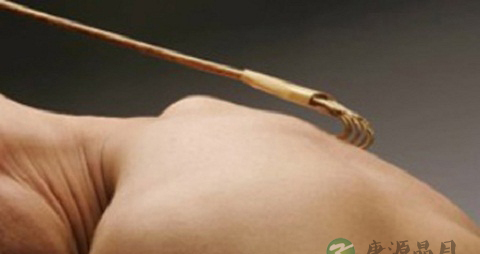 疣状表皮发育不良的原因 疣状表皮发育不良的原因