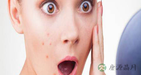 斑疹是什么原因 斑疹是什么原因