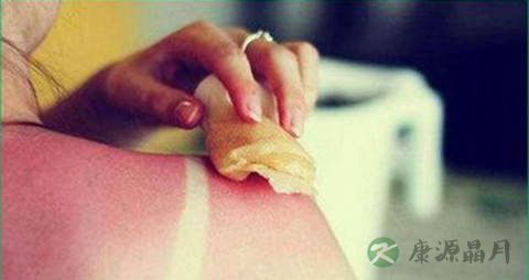 斑丘疹是什么原因 斑丘疹是什么原因