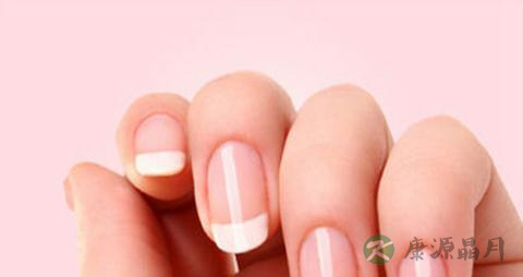 甲癣的症状 甲癣的症状