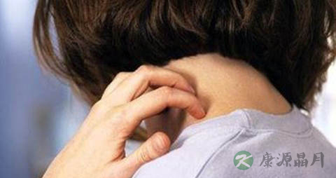 结缔组织病的症状 结缔组织病的症状