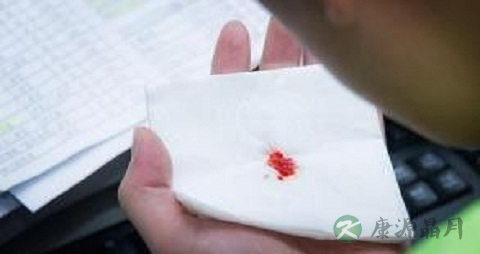 大咯血的症状 大咯血的症状