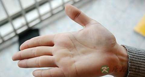 手心热吃什么药 手心热吃什么药