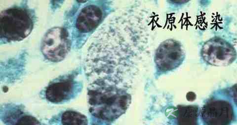 衣原体感染症吃什么药 衣原体感染症吃什么药