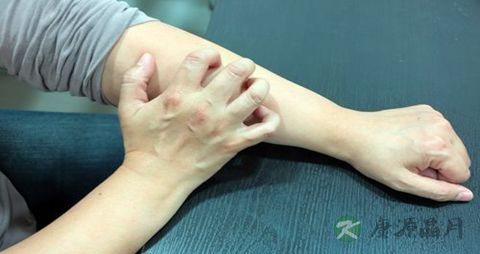 网球肘不能吃什么,网球肘的注意事项 网球肘不能吃什么,网球肘的注意事项