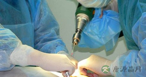 骨盆骨折不能吃什么,骨盆骨折的注意事项 骨盆骨折不能吃什么,骨盆骨折的注意事项