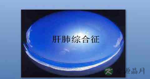 肝肺综合症不能吃什么,肝肺综合症的注意事项 肝肺综合症不能吃什么,肝肺综合症的注意事项