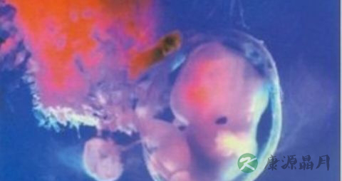 妇科炎症能怀孕吗 妇科炎症能怀孕吗