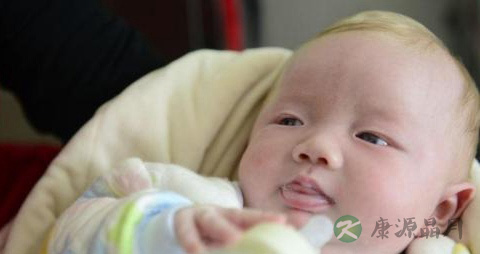 孩子白化病的早期症状 孩子白化病的早期症状
