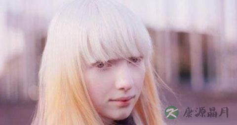 新生儿白化病如何抚育 新生儿白化病如何抚育