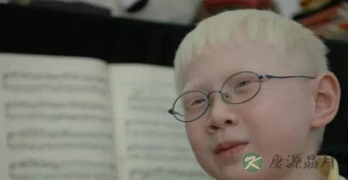 孕妇吃什么预防白化病 孕妇吃什么预防白化病