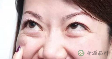 淋巴性白血病吃什么 淋巴性白血病吃什么