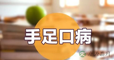 手足口病衣服要分开洗吗 手足口病衣服要分开洗吗