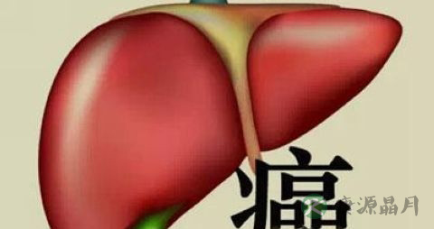 肝癌骨转移是肝癌几期 肝癌骨转移是肝癌几期