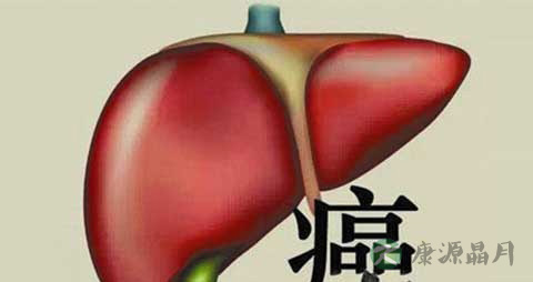 肝癌患者低血糖的原因 肝癌患者低血糖的原因