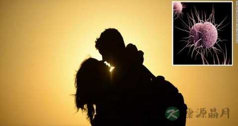 妇女淋病可以治好吗 妇女淋病可以治好吗