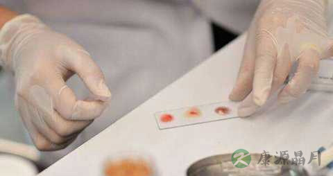 淋病的临床症状及诊断标准 淋病的临床症状及诊断标准